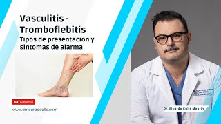 Vasculitis y Tromboflebitis | Presentación y Síntomas de Alarma