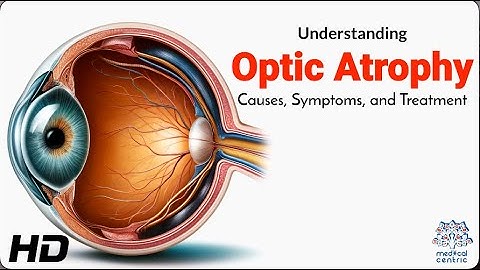 Optic Atrophy Explained: Causes, Symptoms, and Treatment Options