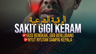 SAKIT GIGI LANGSUNG SEMBUH INSYAALLAH