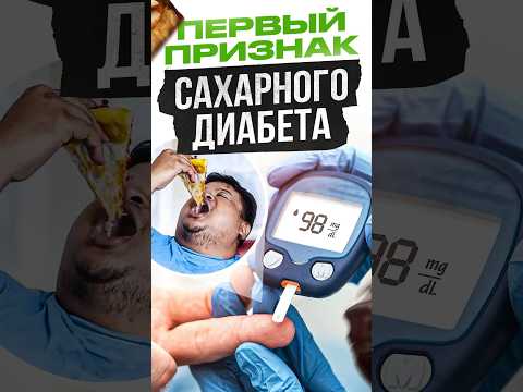 Первый признак САХАРНОГО ДИАБЕТА #сахарныйдиабет #питание #николайпанасюк