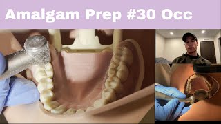 Class 1 Amalgam Prep || #30 O Preparation Class One