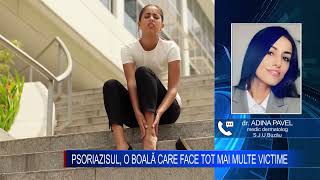 PSORIAZISUL, O BOALĂ CARE FACE TOT MAI MULTE VICTIME