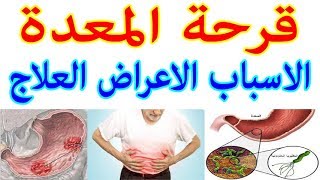 قرحة المعدة اسبابها اعراضها وعلاجها