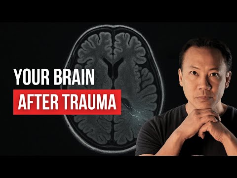 How Trauma Shrinks Your Brain (And How Exercise Reverses It)