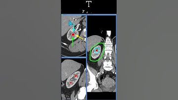 Measurements, Graphical labels and Markers