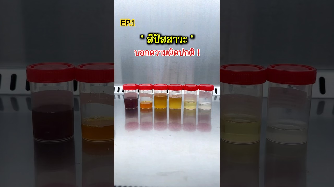 “สีปัสสาวะ” บอกความผิดปกติได้ #ฉันอยู่ในห้องแล็บ