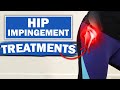 Hip Series (2 of 5):16 Hip Impingement Treatments/ Assessments