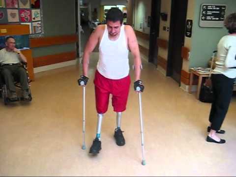 Double Above Knee Amputee Double Above Knee Amputee