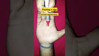 Floating X Sign Infinite Opportunities