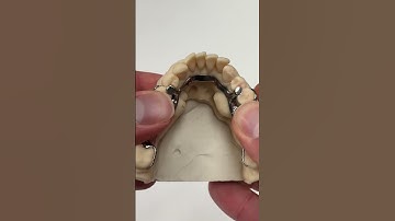 Titanium Partial @EnvisiontecMain #envisiontec #dental #teeth #smile #shorts #lsk121shorts