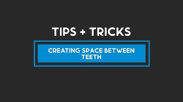 DIBS AI Tips and Tricks: Creating Space Between Teeth