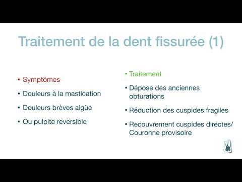 Vidéo: Dent Fissurée: Symptômes, Traitements Et Guérison