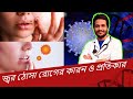 জ্বর ঠোসা সারানোর মেডিসিন | জ্বর ঠোসা কেন হয় | জ্বর ঠোসার প্রতিকার | @sanowarhossain1290