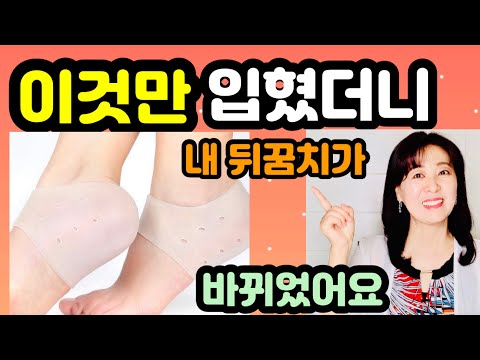 거칠거칠 각질이 무좀때문이라고?/ 발뒤꿈치팩으로 보들보들 한발/발각질. 갈라짐 통증 너무 힘들어요/아스피린 정말 좋아요