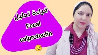 كيفية قراءة تحليل الكالبروتكتن  fecal calprotectin 👍