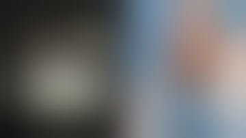 Highlighting the NanoNeedle Scope 2.0 for Meniscal Debridement and Repair