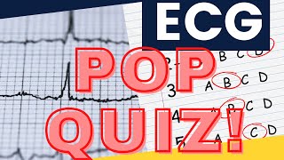 ECG QUIZ for BEGINNERS