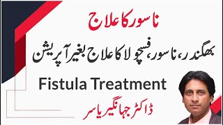 Bhagandar Ka Ilaj | Nasoor ka ilaj | Fistula ka ilaj | Nasoor ka ilaj | Dr Jahangir yasir