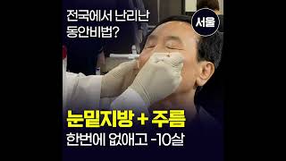 1595미니하안검_정사각