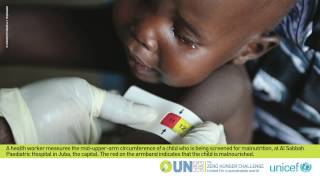 Photo show on child malnutrition UNICEF (EN)