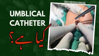 Umblical Catheter Jaundice In New Born Dr Tashfeen.