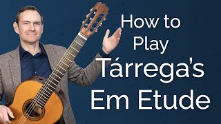 Thumbnail for Tarrega’s Em Etude: Practice Solutions for Effortless Playing