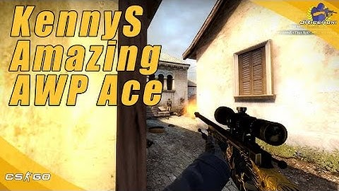 kennyS Sick 5K ACE Vs NIP