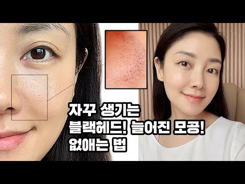 [SUB] 협찬❌  모공, 블랙헤드! 끝장 홈케어부터 피부과 추천시술까지! Pore care & sebum removal routine | 뷰티클라우드 유나 UNA