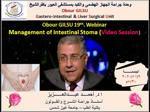 Management Of Intestinal Stoma Video Sessions Prof Ahmed Abdelazeez