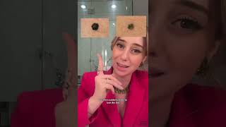 Skin Cancer And Melanomas Part 2