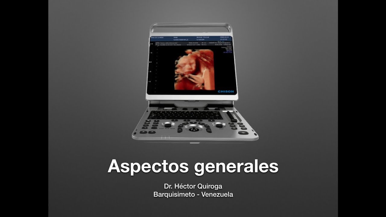 Chison EBit 30  Una guía completa  Primera Parte