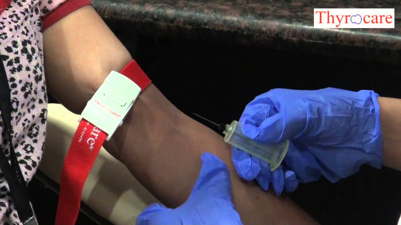 Thyrocare Blood Collation Part 1 YouTube