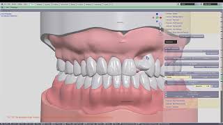 Blender 4 Dental Denture module