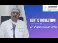 Aortic Dissection: Causes &amp; Treatment Explained | Dr Dinesh Kumar Mittal