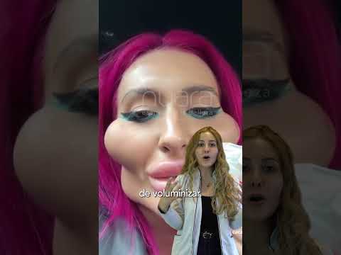 ¡ALERTA! 🚨 Lo Barato en Estética Sale CARO (y puede ser IRREVERSIBLE) l Nuara Belleza