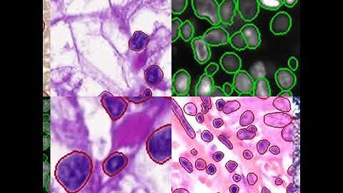 NucleAIzer demo video. Single cell segmentation using deep learning