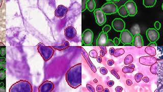 NucleAIzer demo video. Single cell segmentation using deep learning