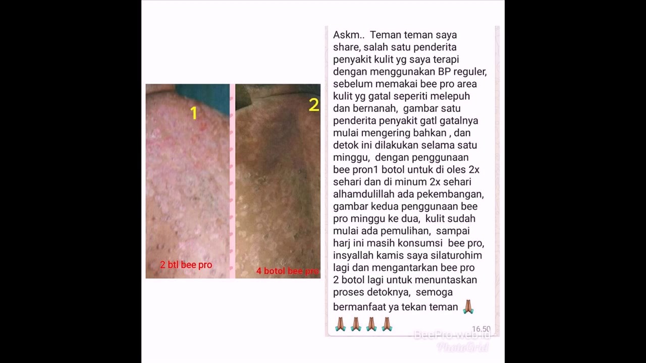 Jenisjenis Obat Anti Diabetes Oral Guesehat Com Jenisjenis Obat Anti Diabetes Oral Guesehat Com