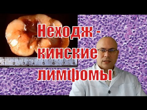 Видео: При неходжкинов лимфом наследствен?