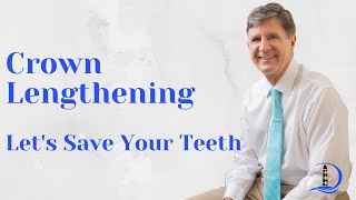 Crown Lengthening Let's Save Your Teeth