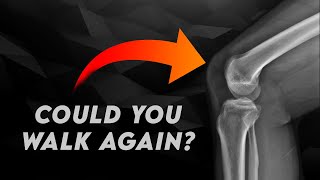 What would happen if you didn’t have a patella?