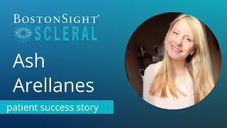Bostonsight Scleral Patient Success Story Ash Arellanes Keratoconus