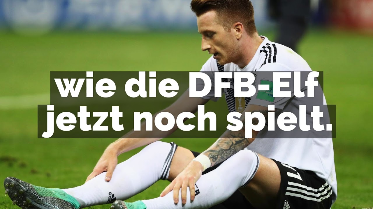 Die DFB-Elf bekommt Hilfe