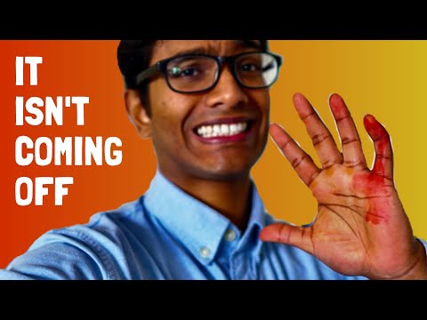 Traumatic Day in the life of a Cambridge University Medical Student 5 Lessons I Learnt