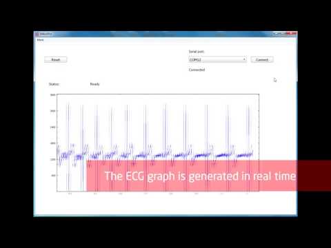 Real time ECG graph in Windows - MikroPlot app by MikroE