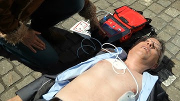 SCHILLER FRED easy when to use a defibrillator
