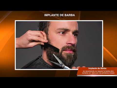 Vídeo: Implantes De Barba: Procedimiento, Costo, Búsqueda De Un Proveedor