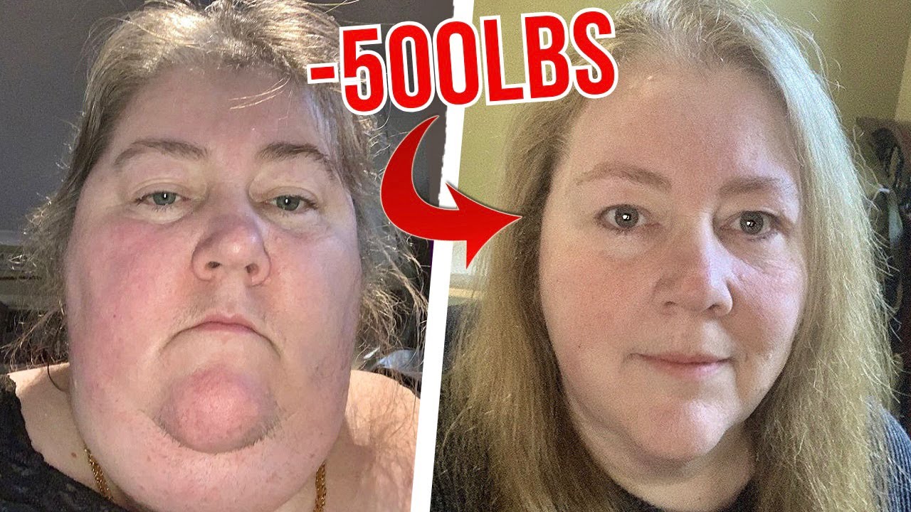 How Going Carnivore Lost Me 500 Pounds | Limitless Lindy