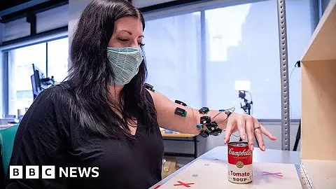 New technology restores movement in limbs of people who suffered strokes - BBC News