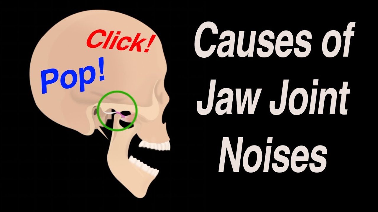 Causes of Jaw Noises: Snap, Pop! -